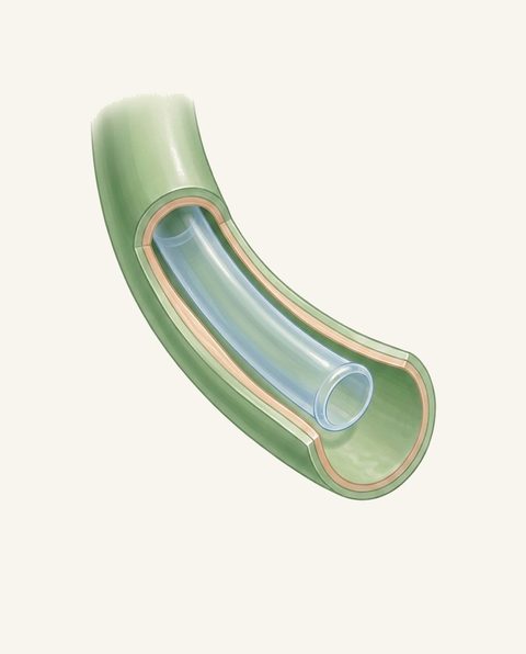 Soft anatomie illustratie van een plastic stent in de galweg